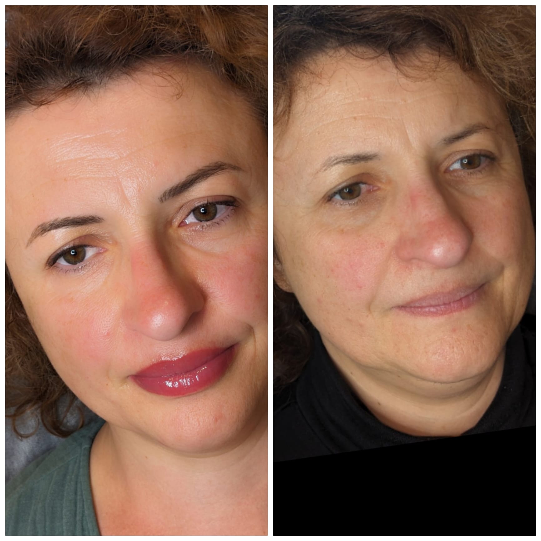 Vorher-Nachher-Seitenvergleich des Permanent-Makeup-Ergebnisses.